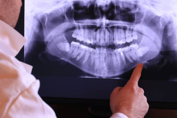 Emergency Dentist Open Today in LA