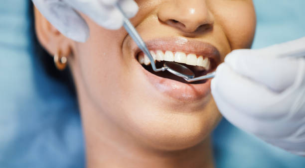 Best Teeth Whitening  in Bayou Lourse, LA