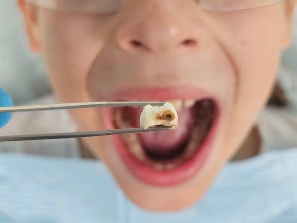 Best Same-Day Dentist Appointment  in Bayou Lourse, LA